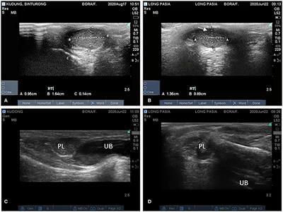 Repeated Evaluations of Testes and Semen Characteristics in Two Binturongs (Arctictis binturong)